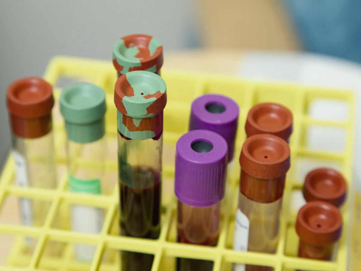 Tubos de análisis de sangre en una gradilla de laboratorio, que es donde se mide la ferritina